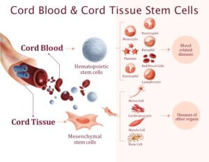 Understanding Cord Blood And Cord Tissue Banking