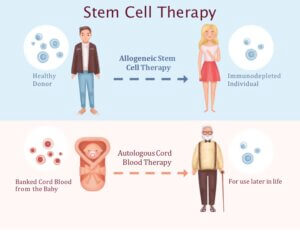 Understanding Cord Blood And Cord Tissue Banking