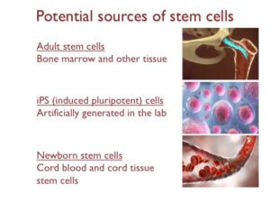 Understanding cord blood and cord tissue banking