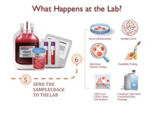 How Cord Blood Banking Works