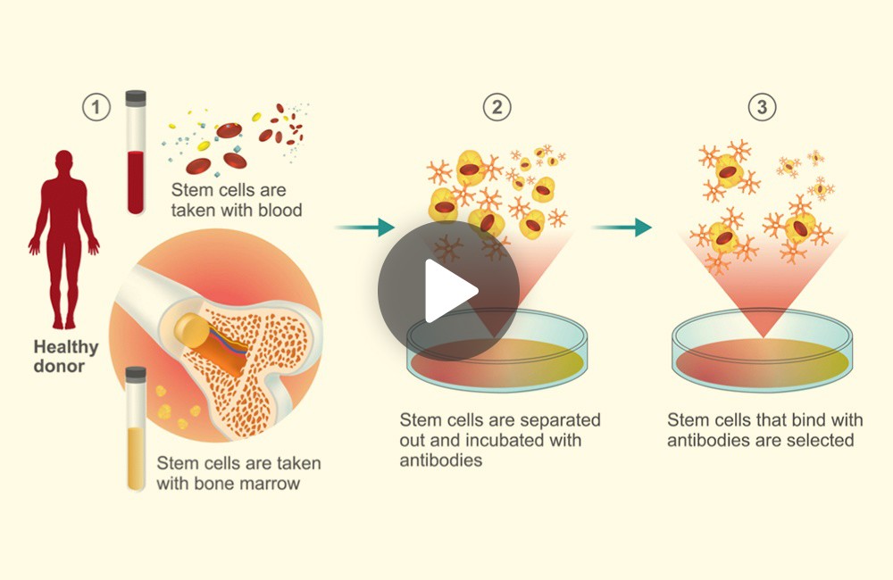The future of stem cell therapy