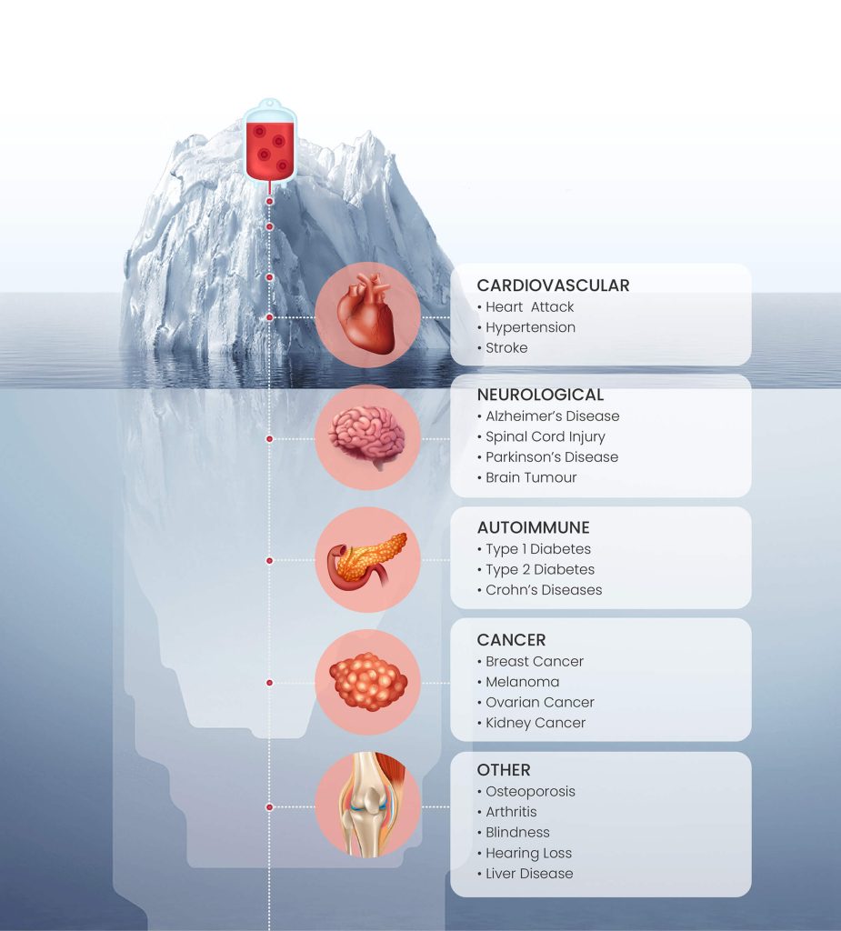 Cord Tissue Banking