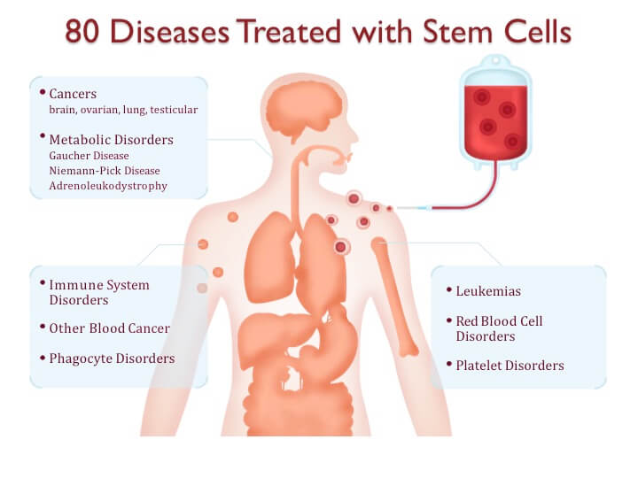 Diagram Of The Categories Of Diseases Currently Treated With Stem Cells.