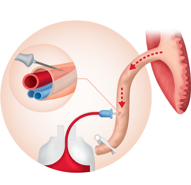 Cord Blood Banking Process